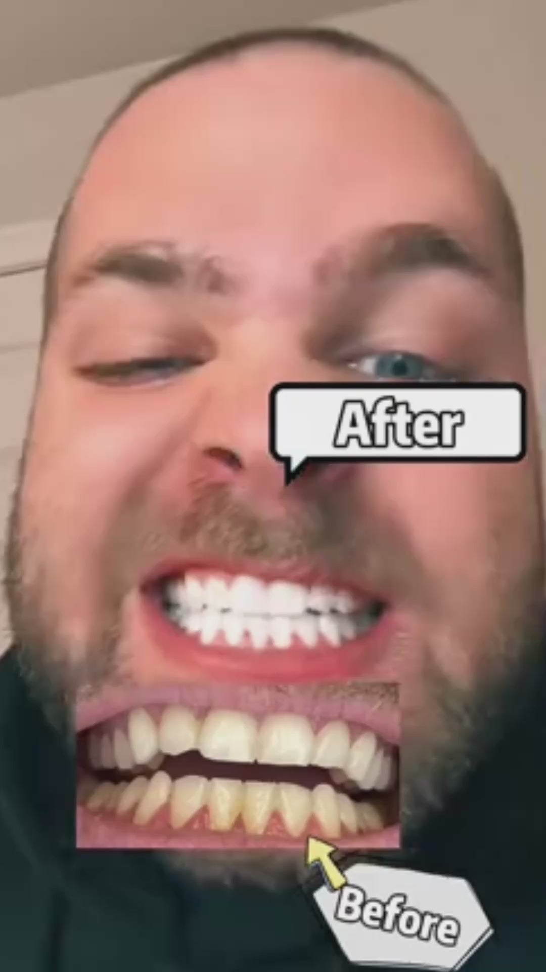 Load video: Niacinamide Whitening Toothpaste